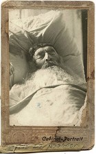JUDAICA MAN WITH CLOSED EYES LYING IN BED 1915 CABINET PHOTO KREMENCHUG UKRAINE picture